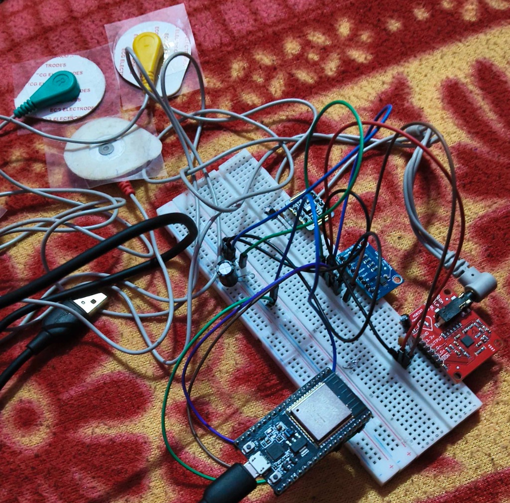 Hardware Rig: ESP32, AD8232 ECG board, MAX30102 PPG sensor, and electrode leads