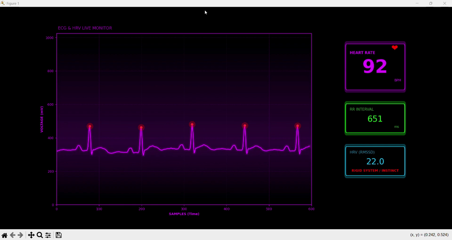 ECG Signal Plot