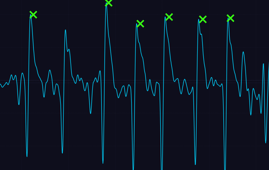 Eye Blink Waveform